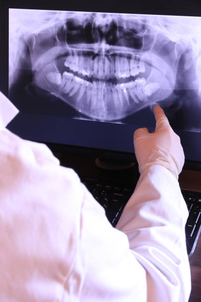 Best Emergency Dentist for Knocked-Out Tooth in Middletown, IN