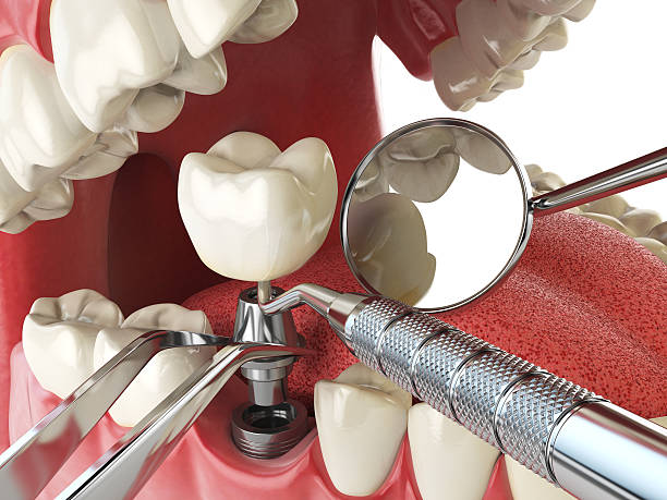 Best Emergency Cosmetic Dentistry in Middletown, IN