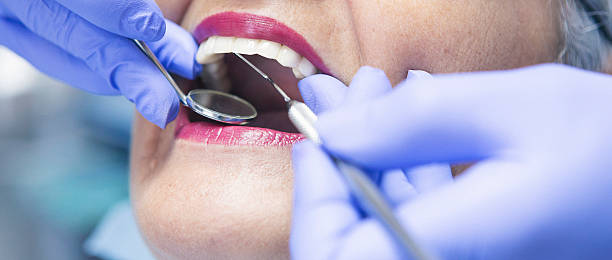Best Emergency Dental Services for Seniors in Middletown, IN